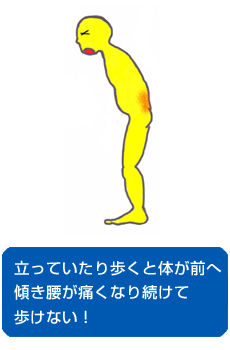 痛くて歩けない